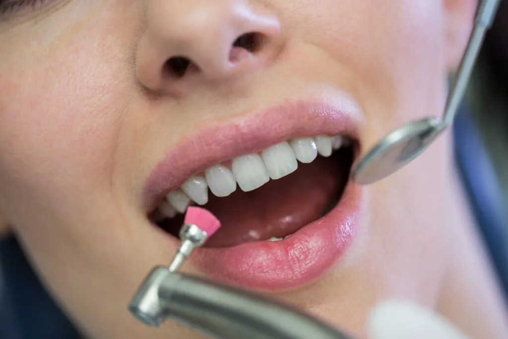 dental crown